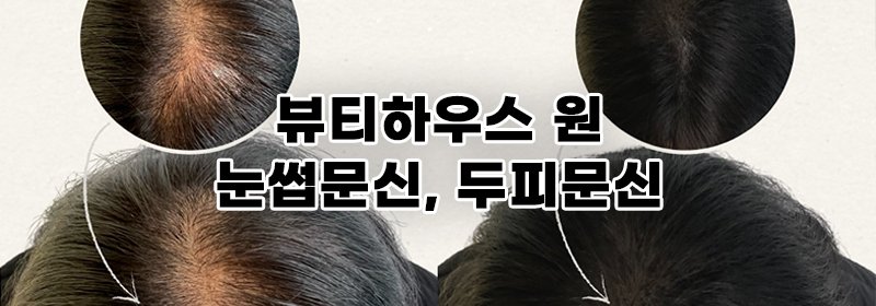 Banner 2
